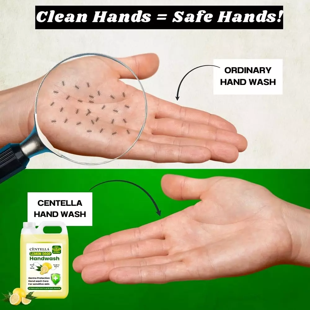 centella-hand-wash-5-l-can-gel-lemon-fragrance-yellow-for-kitchens-offices-industrial-areas