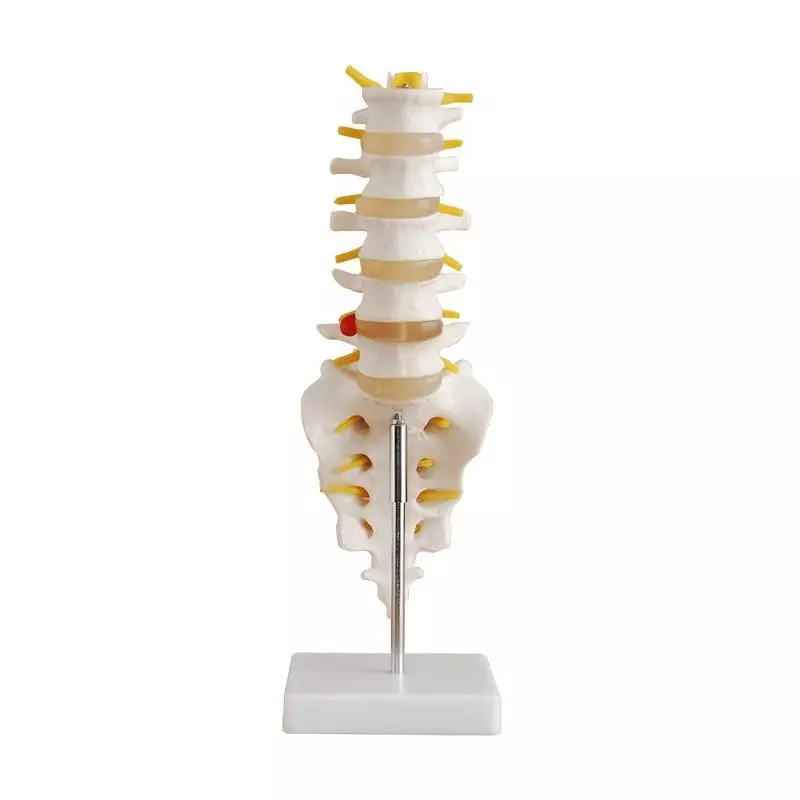 MODELSCART Life Size Lumbar Vertebrae Model with Sacrum & Coccyx and Herniated Disc, Made of PVC Plastic and Mounted on Stand, XC-119