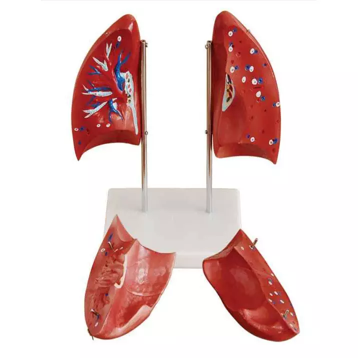 MODELSCART Life Size Lung Model Made of PVC Plastic, Mounted on Stand for Medical Education, XC-321