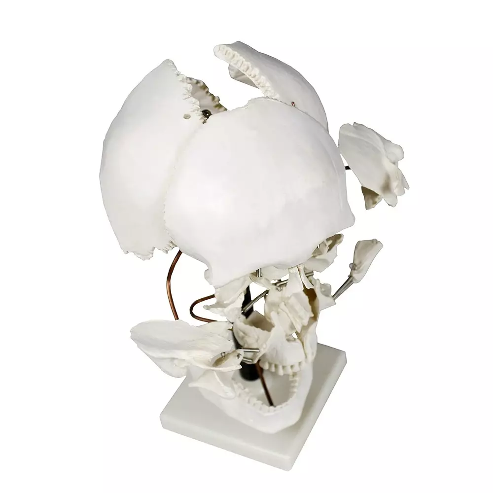 zesco-india-life-size-exploded-skull-model-made-of-pvc-plastic-for-bio-and-medical-labs-zesco-zx-1205