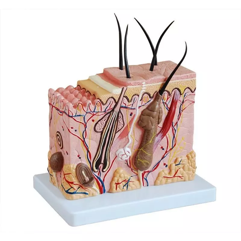 MODELSCART Skin Block Model, 70 Times Natural Size Made of PVC, Mounted on Plastic Base for Medical Education, XC-313-2