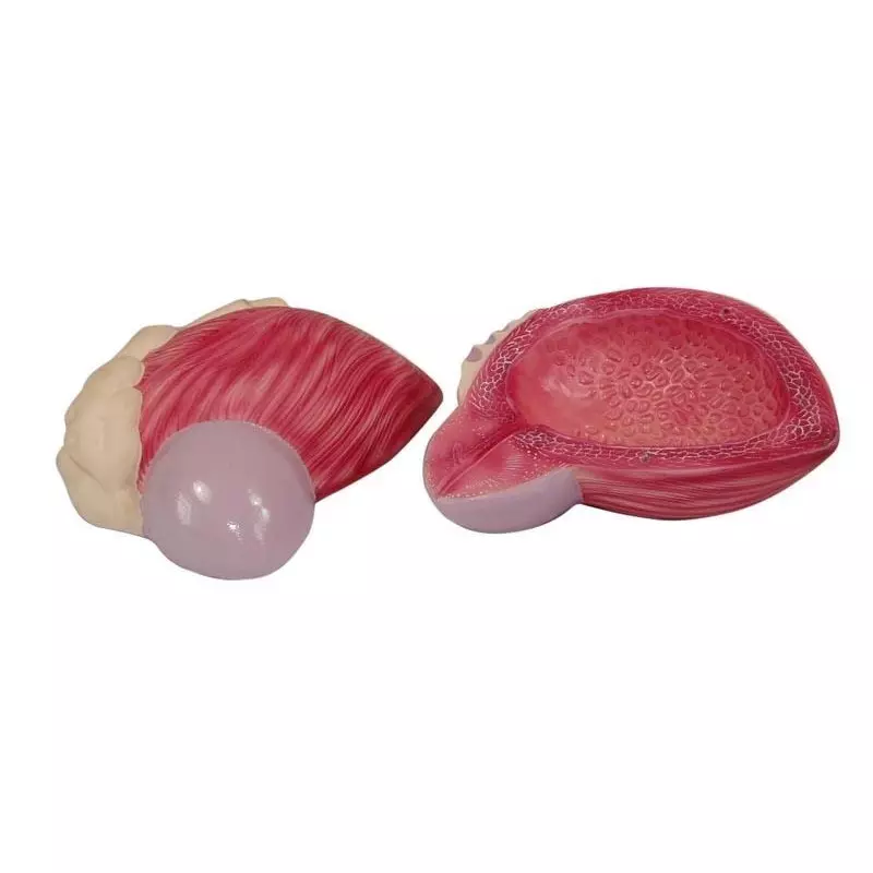 MODELSCART Expansion Model of Urinary Bladder, Made of PVC Plastic for Medical Education & Training, XC-317