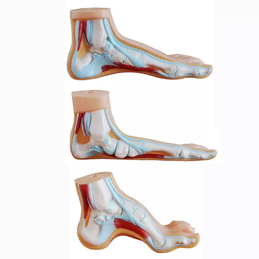 MODELSCART Life Size Normal, Flat, Arched Foot Model Made of PVC Plastic for Medical Education & Training, XC-326 (Set of 3)
