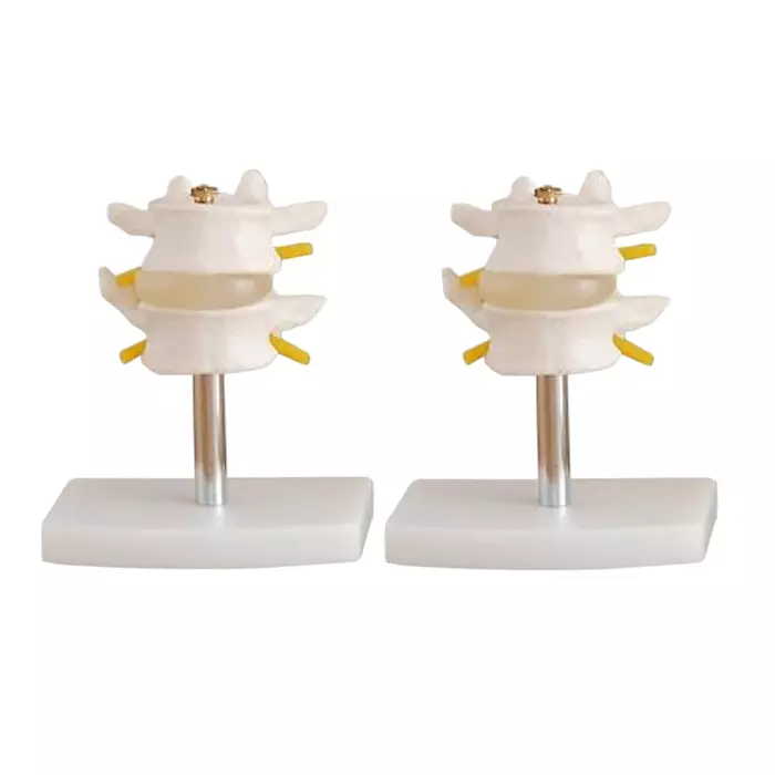MODELSCART Life Size Lumbar Set Made of PVC Plastic, Stand Mounting for Medical Education, XC-116 (Set of 2)