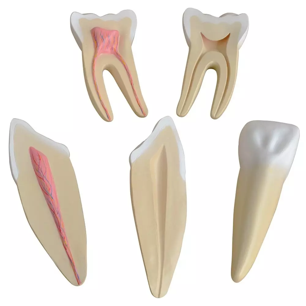 MODELSCART Expansion Model of Human Teeth, 12 Times Life Size Made of PVC Plastic for Medical Education & Training, XC-305 (Set of 3)