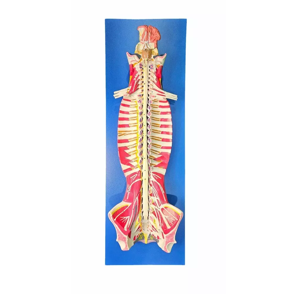 MODELSCART Spinal Cord in the Spinal Canal Model, Made of Advanced PVC, Mounted on Board for Medical Education & Training, RX-A18102