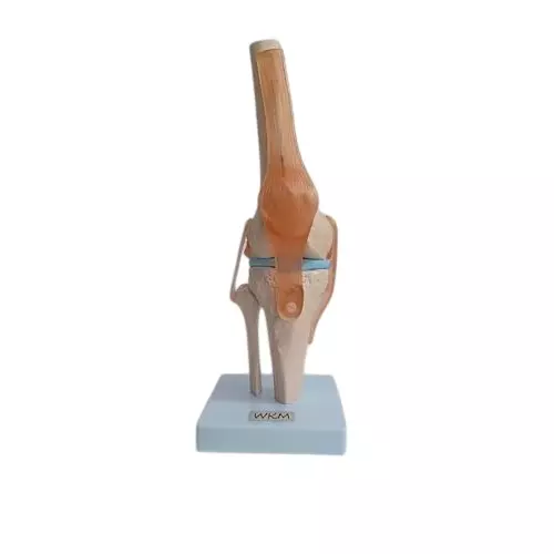 wkm-flexible-knee-joint-model-with-acl-pcl-lcl-mcl-realistic-human-knee-anatomy-for-medical-education-durable-deformity-free-model-ideal-for-students-doctors-physiotherapists