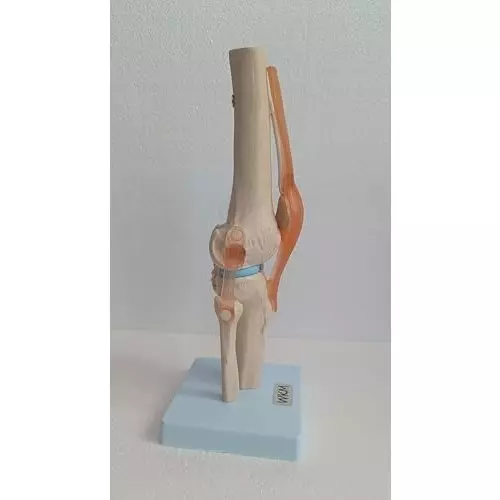 wkm-flexible-knee-joint-model-with-acl-pcl-lcl-mcl-realistic-human-knee-anatomy-for-medical-education-durable-deformity-free-model-ideal-for-students-doctors-physiotherapists