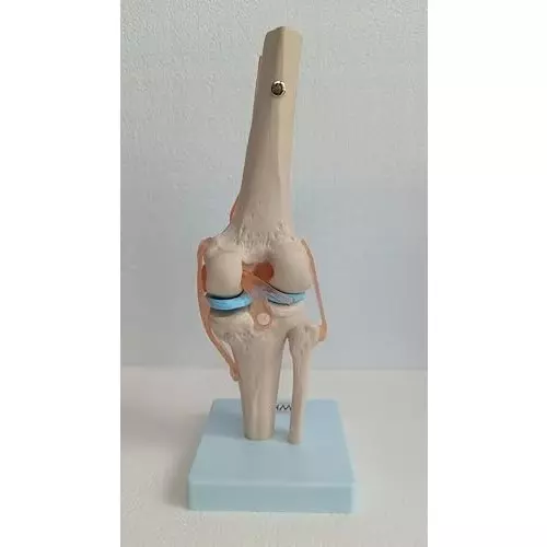 wkm-flexible-knee-joint-model-with-acl-pcl-lcl-mcl-realistic-human-knee-anatomy-for-medical-education-durable-deformity-free-model-ideal-for-students-doctors-physiotherapists