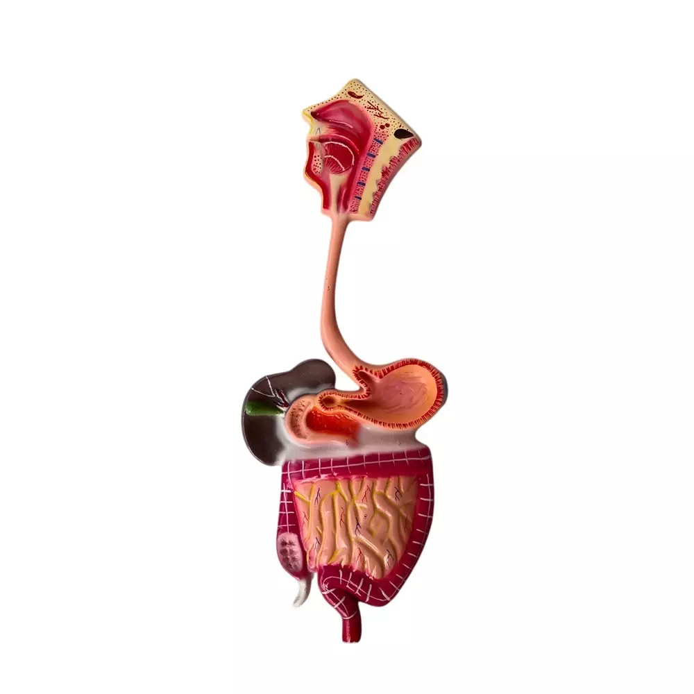 WKM Human Digestive System Model on Board Showing Large Stomach, Small & Large Intestine Anatomy, Pathological Stomach Section
