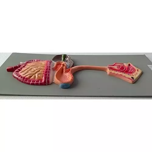 wkm-teaching-digestive-system-model-on-borad-model-human-stomach-anatomy-model-pathological-stomach-section-large-small-intestine-medical-model-anatomy