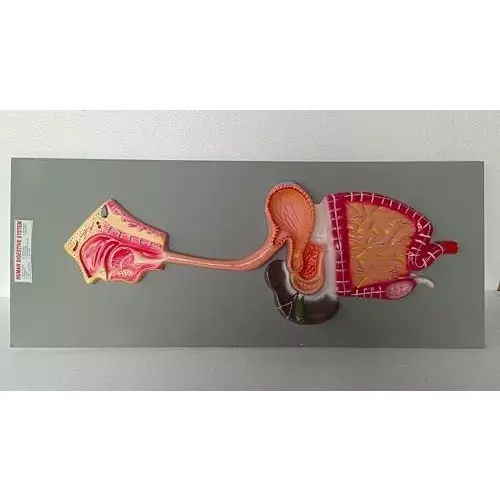 wkm-teaching-digestive-system-model-on-borad-model-human-stomach-anatomy-model-pathological-stomach-section-large-small-intestine-medical-model-anatomy