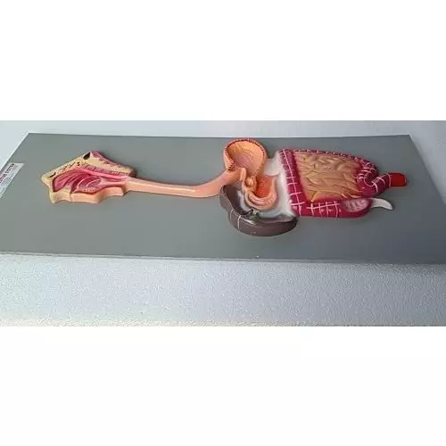 wkm-teaching-digestive-system-model-on-borad-model-human-stomach-anatomy-model-pathological-stomach-section-large-small-intestine-medical-model-anatomy