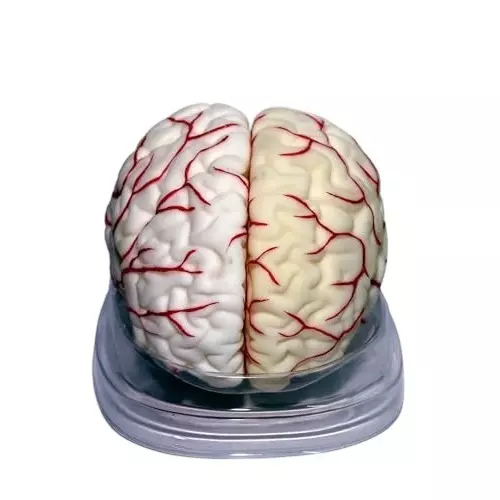 WKM Life-Size Human Brain Anatomical Model Silicone 8-Parts Removable with Arterial Markings