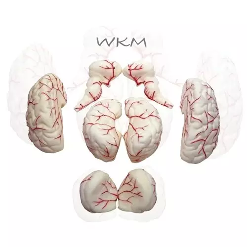 wkm-silicone-life-size-anatomy-human-brain-model-removable-in-8-parts-features-of-brain-and-its-arterial-supply-brain-model-for-classroom-study-display-teaching-anatomy-19x16x13-cm