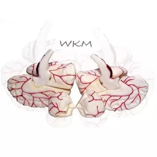 wkm-silicone-life-size-anatomy-human-brain-model-removable-in-8-parts-features-of-brain-and-its-arterial-supply-brain-model-for-classroom-study-display-teaching-anatomy-19x16x13-cm
