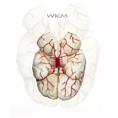wkm-silicone-life-size-anatomy-human-brain-model-removable-in-8-parts-features-of-brain-and-its-arterial-supply-brain-model-for-classroom-study-display-teaching-anatomy-19x16x13-cm
