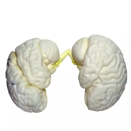 WKM Life-Size 3D Human Brain Model Removable 19x16x13 cm for Classroom Teaching & Medical Study