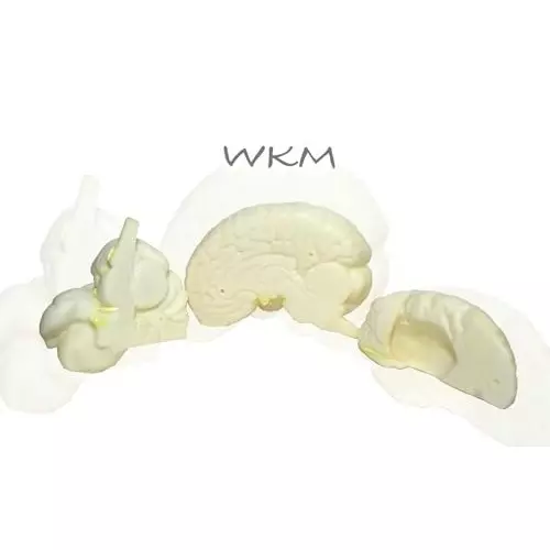wkm-3d-human-brain-model-structure-life-size-anatomy-removable-in-3-parts-features-of-brain-brain-model-for-classroom-study-display-teaching-anatomy-19x16x13-cm