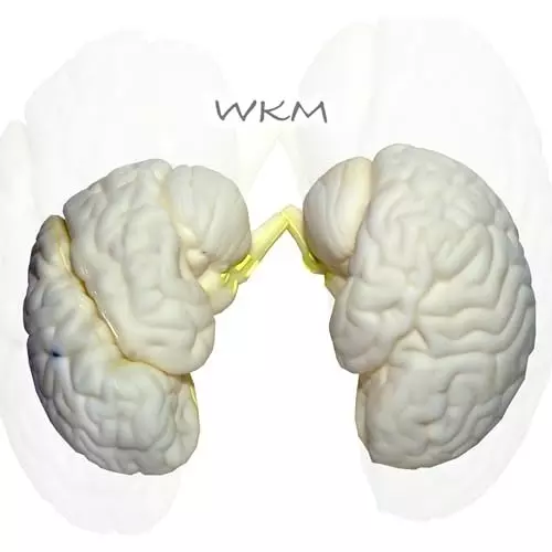 wkm-3d-human-brain-model-structure-life-size-anatomy-removable-in-3-parts-features-of-brain-brain-model-for-classroom-study-display-teaching-anatomy-19x16x13-cm