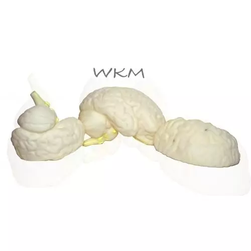 wkm-3d-human-brain-model-structure-life-size-anatomy-removable-in-3-parts-features-of-brain-brain-model-for-classroom-study-display-teaching-anatomy-19x16x13-cm