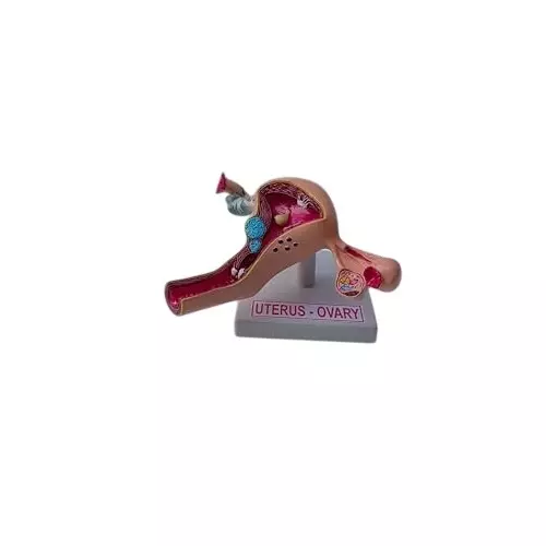 wkm-life-size-uterus-ovary-pathologies-anatomy-model-for-medical-educational-use-model-with-stand-fiberglass-anatomical-model-for-medical-students-healthcare-professionals