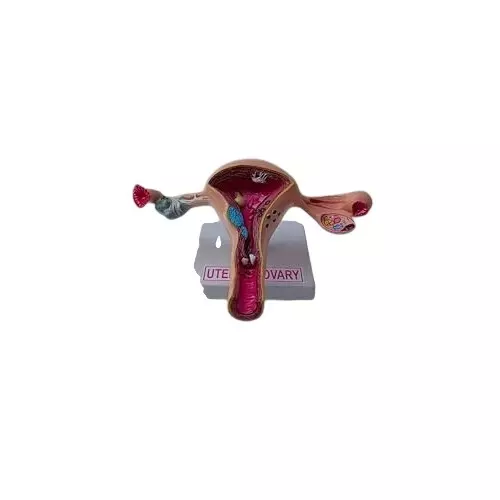 wkm-life-size-uterus-ovary-pathologies-anatomy-model-for-medical-educational-use-model-with-stand-fiberglass-anatomical-model-for-medical-students-healthcare-professionals