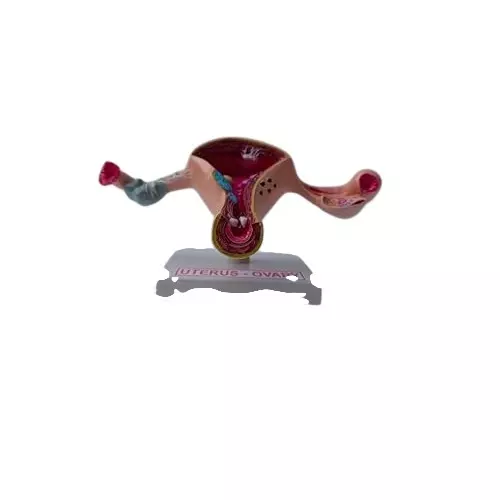 wkm-life-size-uterus-ovary-pathologies-anatomy-model-for-medical-educational-use-model-with-stand-fiberglass-anatomical-model-for-medical-students-healthcare-professionals