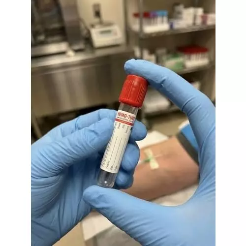 fairbizps-non-vacuum-blood-collection-tube-4-ml-capacity-red-top-fsbr010526-pack-of-100